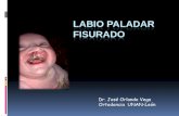 Cleft and lip palate