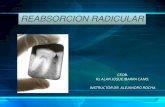 Reabsorcion radicular en ortodoncia