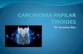 Carcinoma papilar tiroides