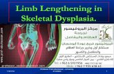 تطويل قصار القامه - Lengthening in skl.dysplasia  - البروفيسور فريح ابوحسان