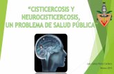 Cisticercosis y neurocisticercosis