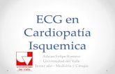 ECG en Cardiopatía Isquémica