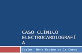 Caso clínico electrocardiografia