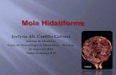 Mola hidatiforme y Caso Clinico
