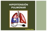 Hipertensión Pulmonar - Dr. Bosio