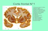 Corte coronal de encefalo