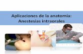 Anestesias intraorales