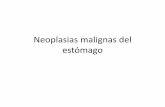 Neoplasias Malignas Del EstóMago