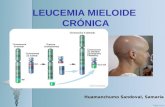 Leucemia Mieloide Crónica- Huamanchumo Sandoval Samaria