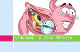 Úlcera Péptica- Fisiopatología