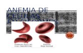 Anemia de células falciformes mt