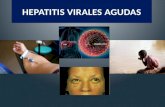 Hepatitis virales okk