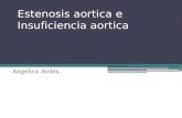 Estenosis aortica e insuficiencia aortica