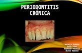 Periodontitis crónica