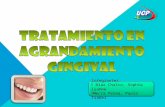 AGrandamiento gingival by pao y sophi
