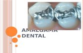 Amalgama dental