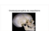 Ostéodystrophie du maxillaire