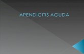 Apendicitis aguda nine