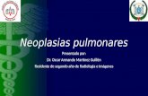 Neoplasias pulmonares Dr. Martínez Guillén