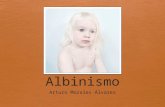 Albinismo [Clase Genetica] - Universidad del Valle de México Campus Vhsa. Arturo A.