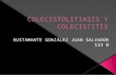 Colecistolitiasis y colecistitis