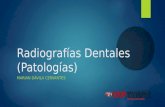 Radiografías dentales (patologías)