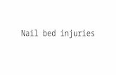 Nail bed injuries