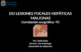 Lesiones focales hepaticas malignas