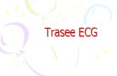 Trasee ECG