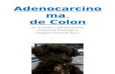 Adenocarcinoma de Colon.pptx