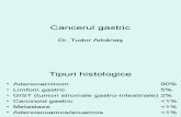 4.Cancerul Gastric