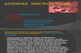 Anemia Macrocitica