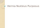 Hernia Nukleus Purposus.pptx
