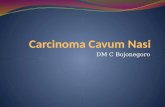 Carcinoma Cavum Nasi Restu