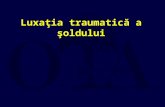 ATT_1434369275948_Luxatia Traumatica a Soldului