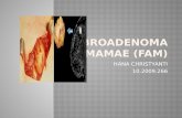 Fibroadenoma Mamae (Fam)-Hana