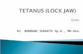 Tetanus (Lock Jaw)