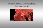Perikarditis, Miokarditis, Endokarditis