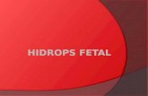 Hidrops Fetal