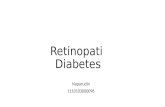 Retinopati Diabetes