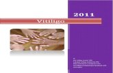 Vitiligo eBook v1