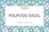 Poliposis Nasal