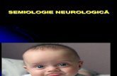 Semiologie neurologica