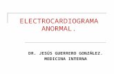 Electrocardiograma (ECG) Anormal