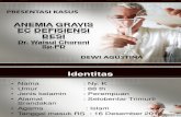 Anemia Gravis