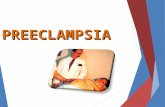Pre Eclampsia