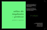 Atlas Protese Sobre Implante