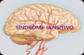 Exposicion Sindrome Sensitivo