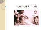 MALNUTRITION PRESENTASI CC GANES.pptx