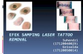 tattoo removal.ppt